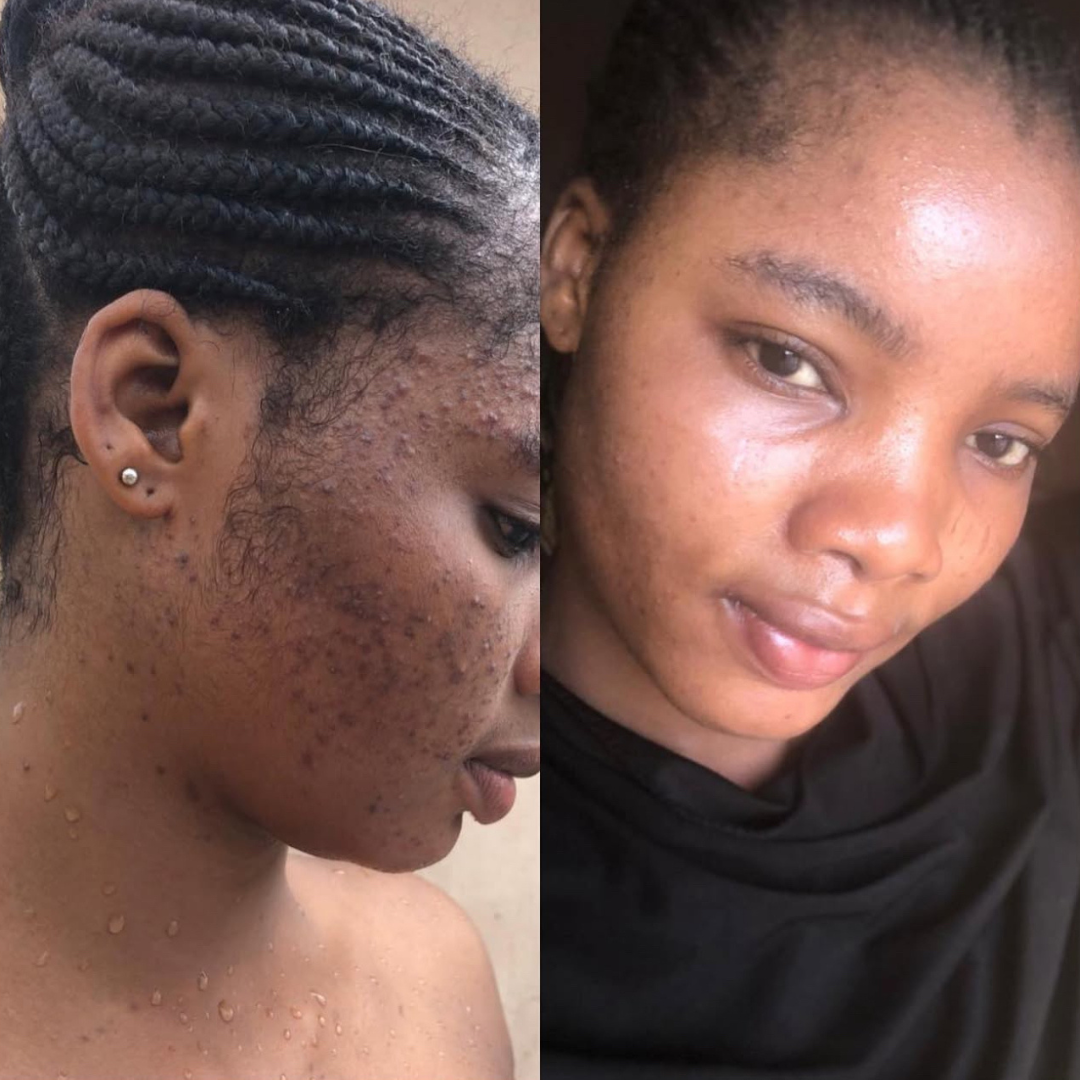 Skin Reset